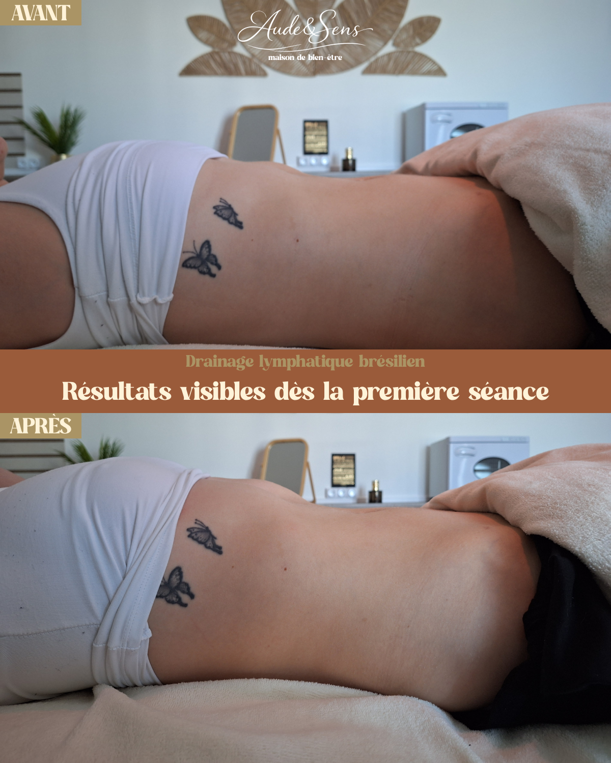 Avant Apres Drainage lymphatique à marmande